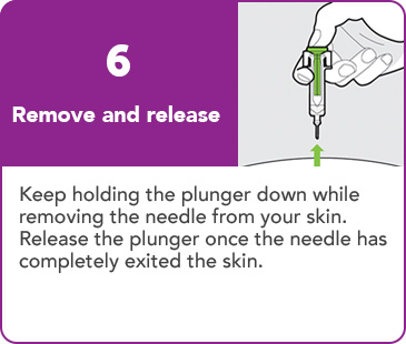 Step 6: Remove and release